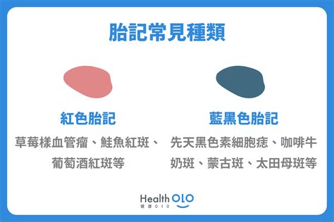 新生兒 胎記|胎記怎麼產生、何時消除？醫師剖析胎記種類、胎記寓意